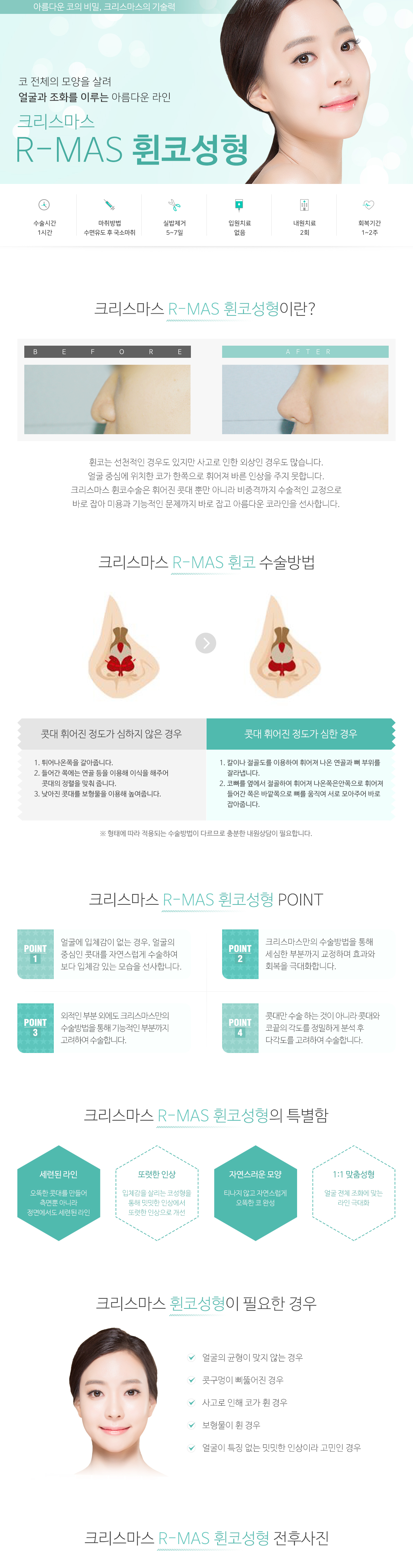 휜코성형